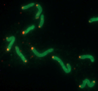Ulcer-causing bacteria tamed by defect in cell-targeting ability