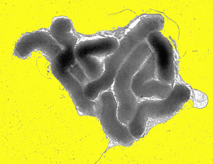 Bacteria may protect against disease caused by stomach infection