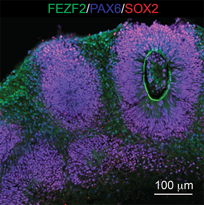 Purple and green staining on an organoid