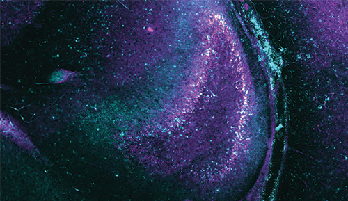 How optogenetics can put the brakes on epilepsy seizures
