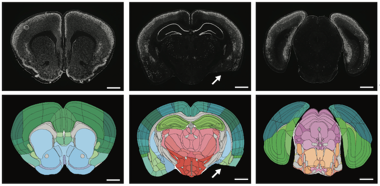 Student-built app slashes weeks off brain mapping to speed up neuroscience research