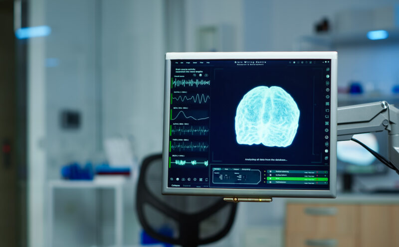 ‘Future-guided’ AI improves seizure prediction
