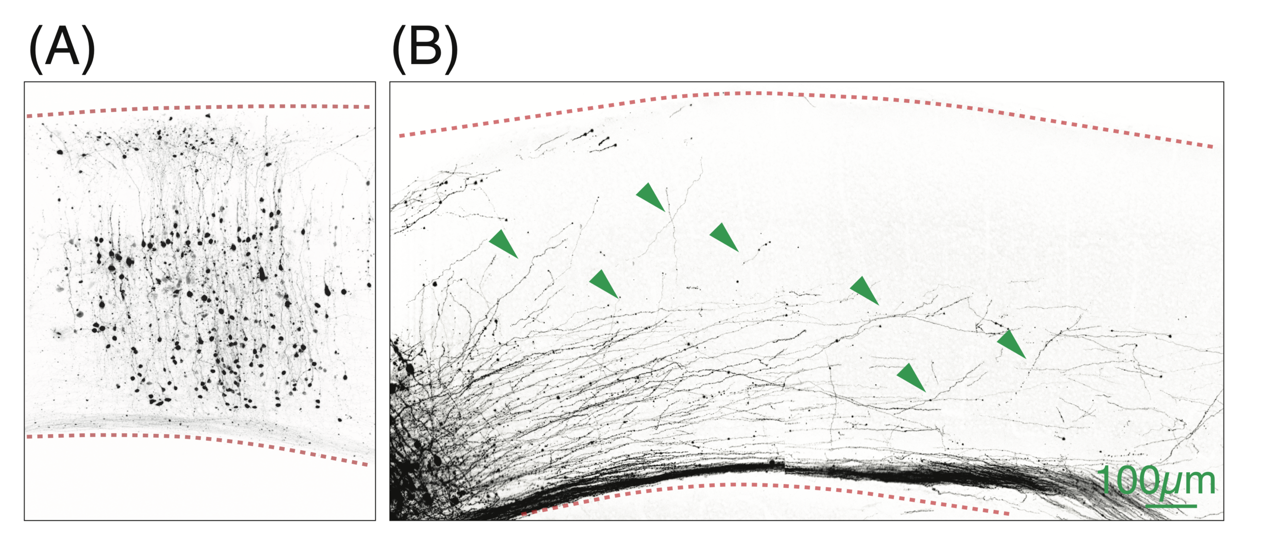 Magnification of nerve-fiber growth, shown from two perspectives