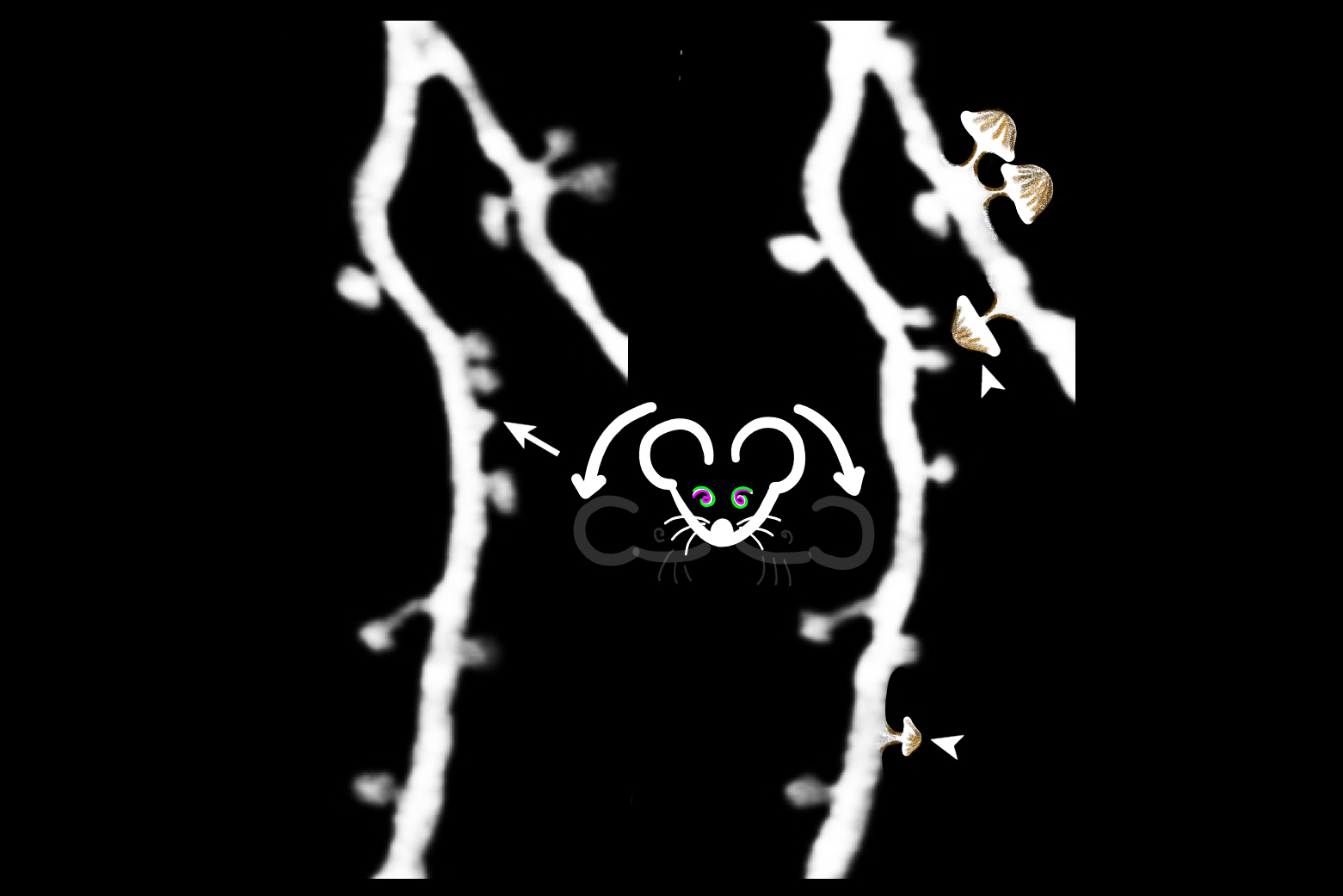 Two strands of dendrites with a cartoon mouse head in between and small mushrooms branching from dendrite on the right